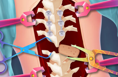 Anna Scoliosis Surgery