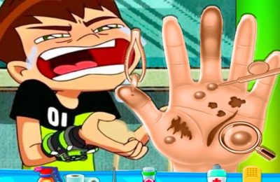 Ben10 Hand Doctor – Free Online Game